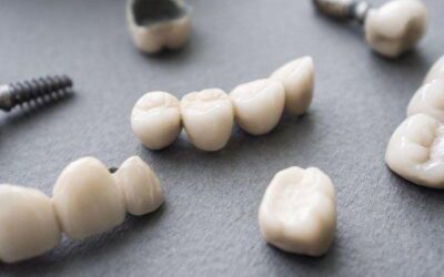 Restorative Dentistry: What Is It?